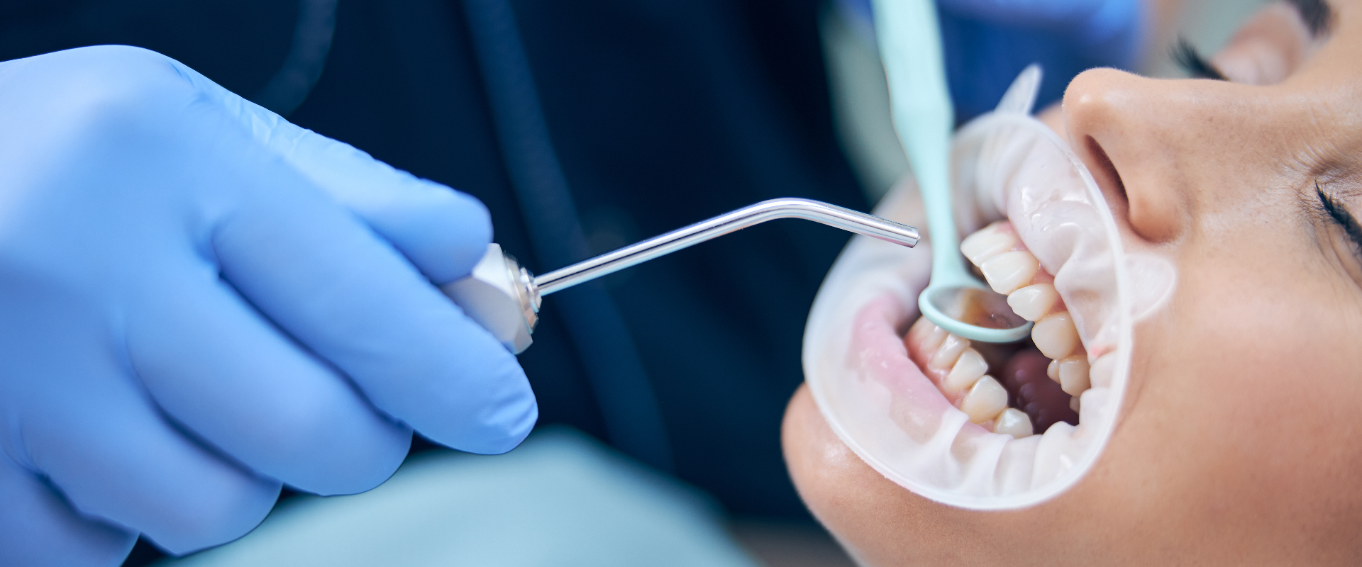Tooth Cleaning