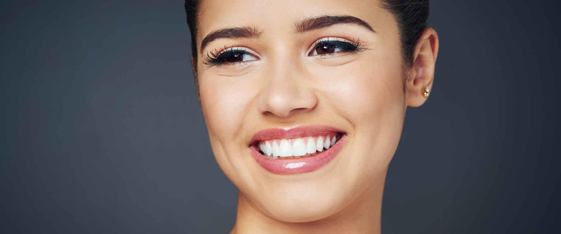 Hollywood Smile