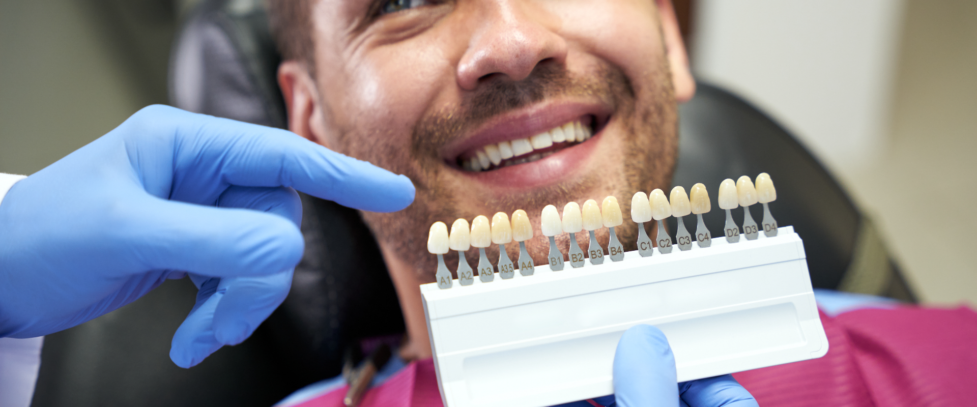 Veneers