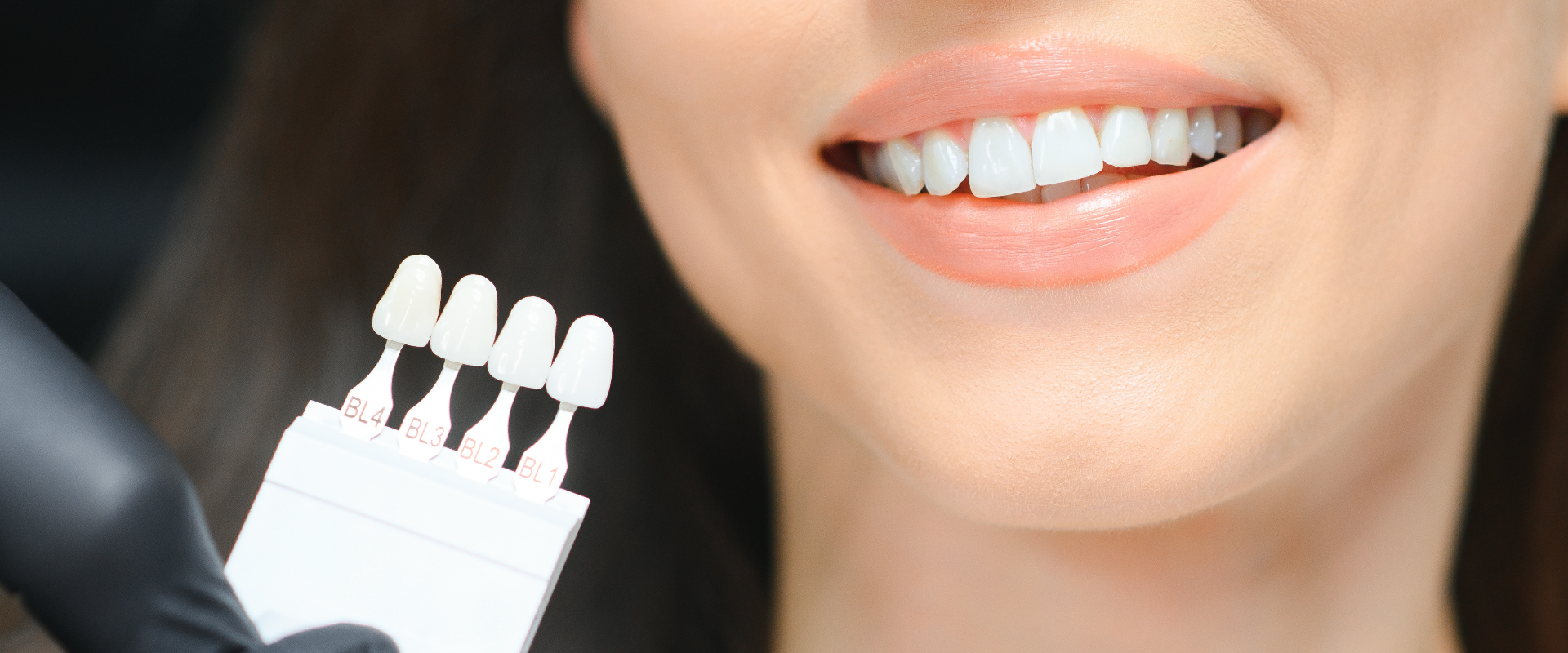 Teeth Whitening