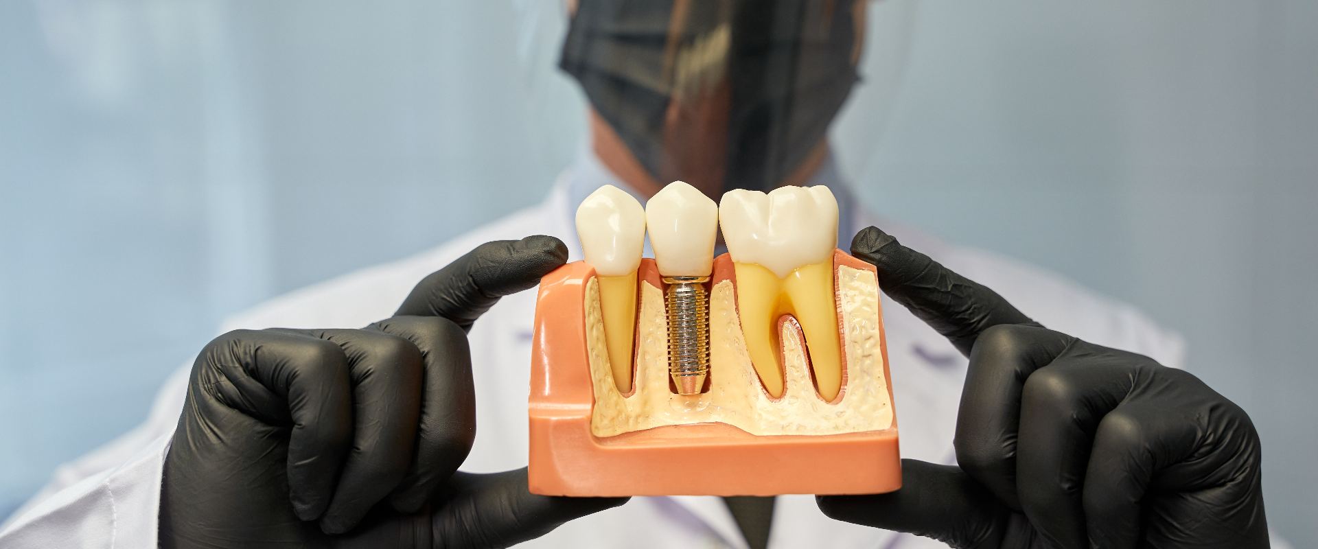 Dental Implants